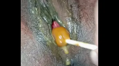 XNXX