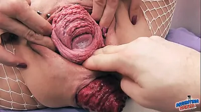 XNXX