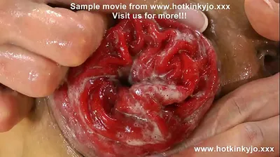 XNXX