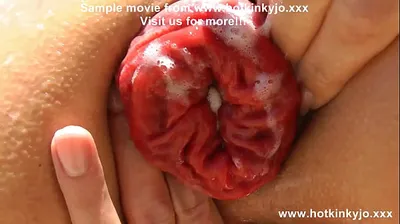 XNXX