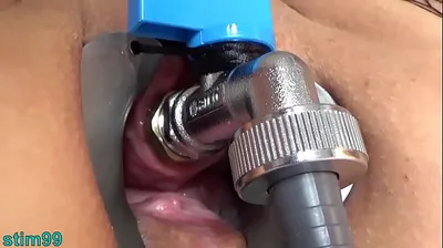 XNXX