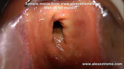 XNXX