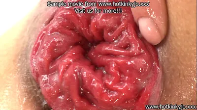 XNXX