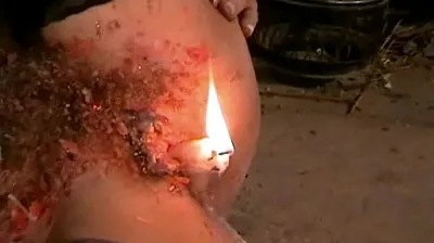 XNXX