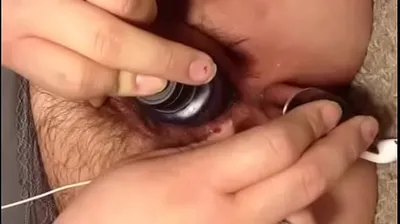 XNXX