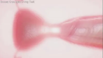XNXX