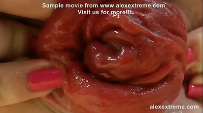 XNXX