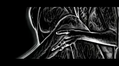 XNXX