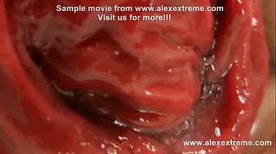 XNXX