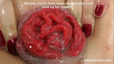 XNXX