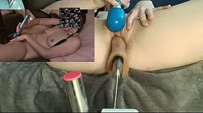 XNXX