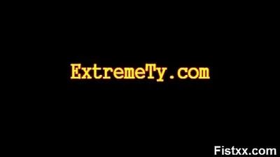 XNXX