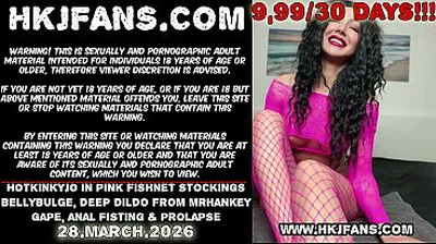 XNXX