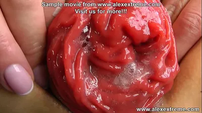 XNXX
