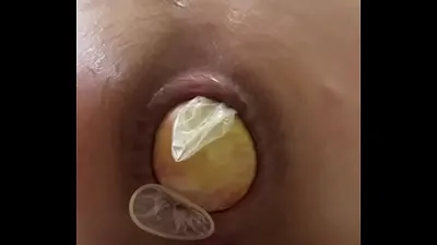 XNXX
