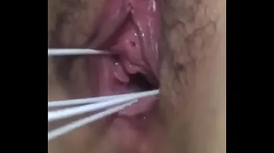 XNXX