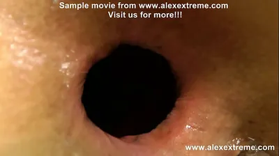XNXX