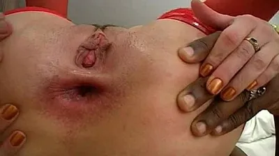 XNXX