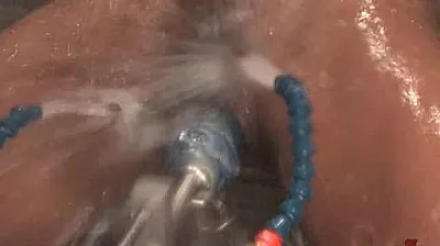 XNXX