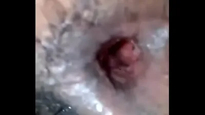 XNXX