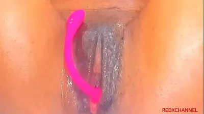 XNXX