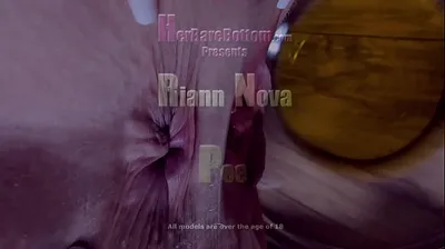 XNXX