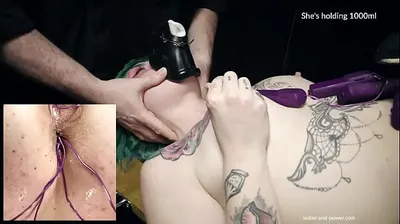 XNXX